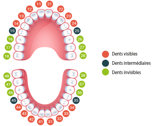 dentition dents remboursées 100% santé